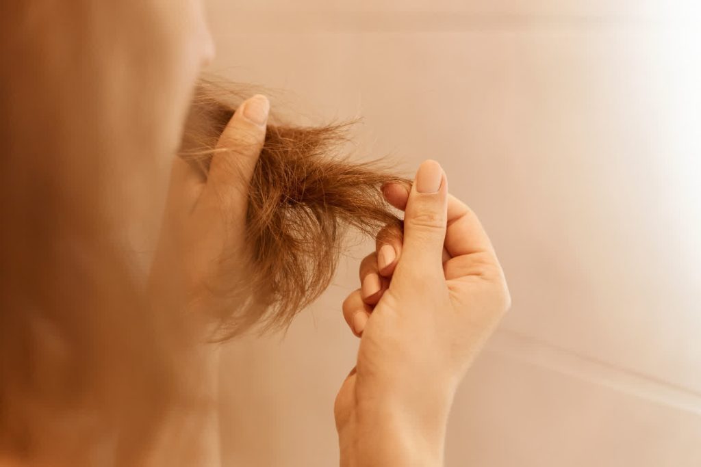 Queda de cabelo acima do normal: Como identificar os sinais e quando buscar ajuda médica